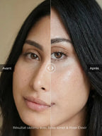 Before and after skincare results showing brighter, hydrated and glowing skin after using rose toner and facial elixir for improved radiance and skin texture.