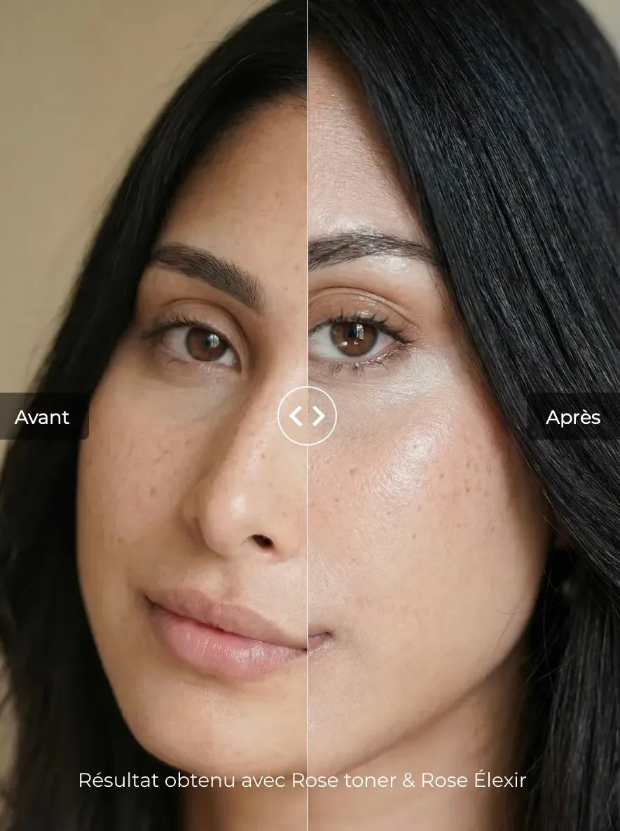 Before and after skincare results showing brighter, hydrated and glowing skin after using rose toner and facial elixir for improved radiance and skin texture.