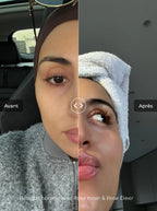 Before and after skincare transformation showing smoother, plumper and glowing skin after using rose toner and facial elixir for hydration and radiance.